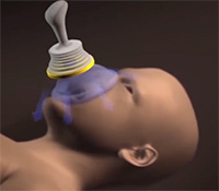 LifeVac product review mannequin